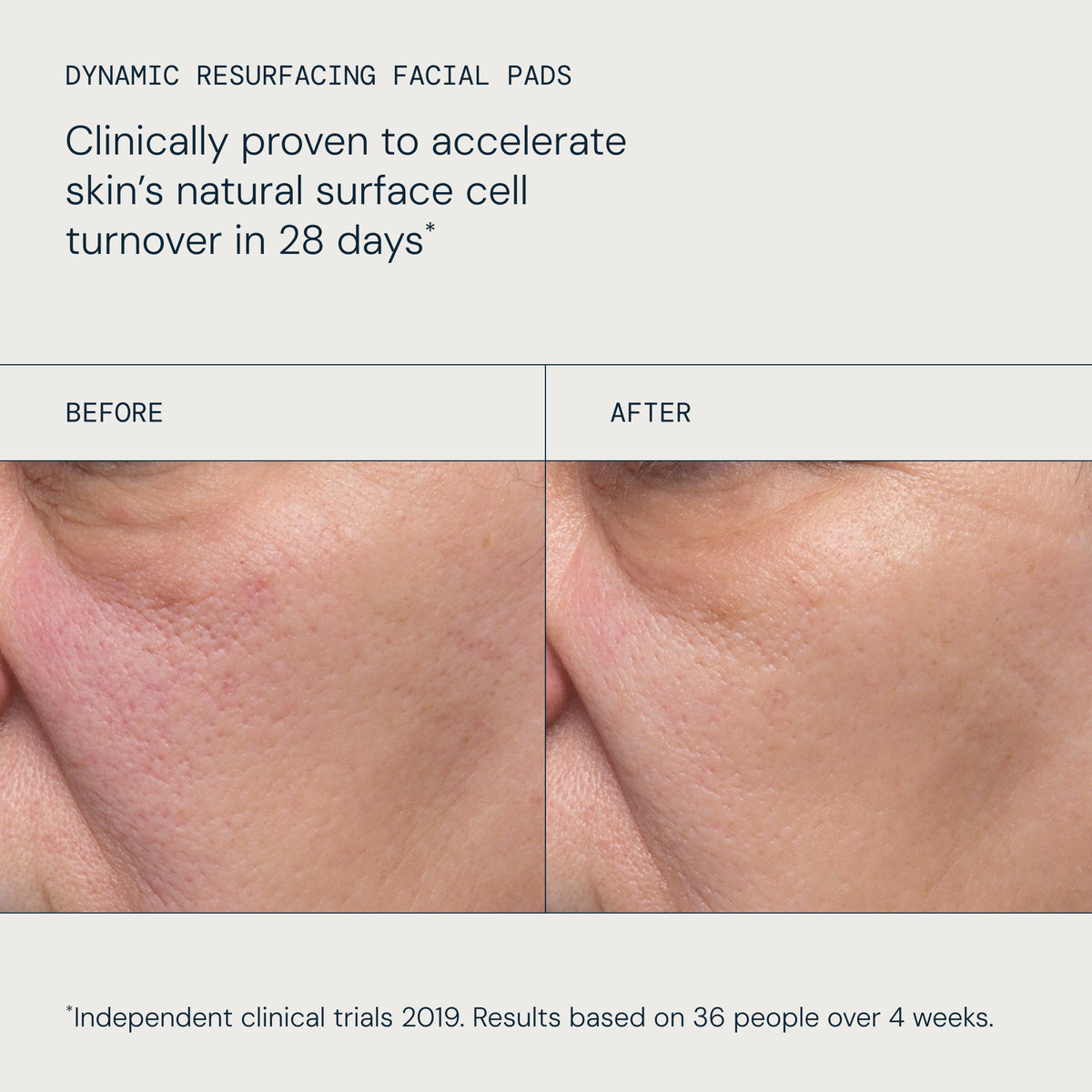 Resurface and Glow Duo